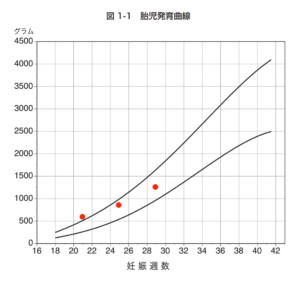 2人目 妊娠8ヶ月目の記録 Lifey 2人目 妊娠8ヶ月目の記録 Lifey